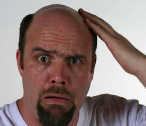 Önlenemeyen bela: Saç dökülmesi!