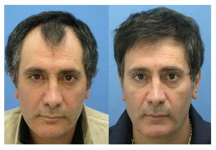 Dış Görünümünüze Önem verin