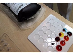 Kan grubunuz "Bombay" olabilir