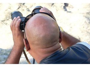 Kellik kalp hastalıklarının habercisi olabilir