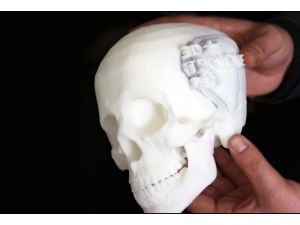 3 boyutlu yazıcıyla tüm kemikleri ürettiler