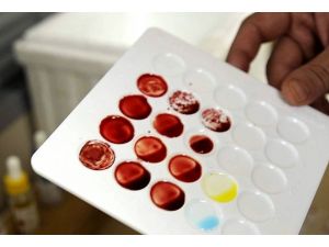 10 milyon kişinin kolestrolü yüksek