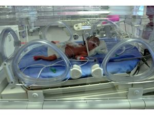 Prematürelere anne kokusuyla tedavi