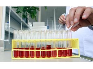 EÜ hemofili hastalarının umudu olacak