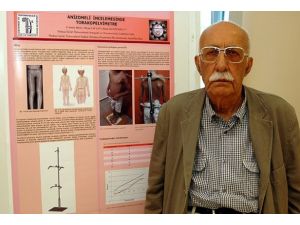 Bacak kısalığını tespit edecekler