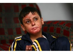 Suriyeli İbrahim, kaybettiklerini geri istiyor