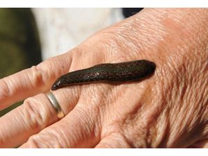 Boğazından 12 santimetrelik canlı sülük çıktı