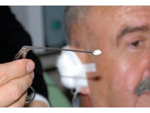 Sigara kağıdıyla kulak zarı tedavisi