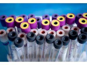 Hepatit B, C ve D virüsleri "sinsi" gelişiyor