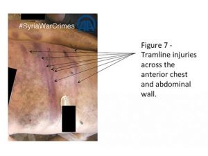 İşkenceyi Özel Soruşturma Komisyonu tespit etti