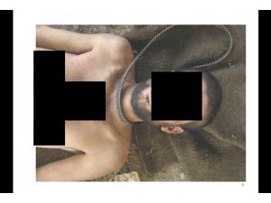 Deliller işkenceyi kanıtlıyor