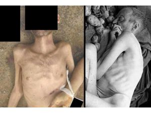 Fotoğraflar 'Suriye holokostunu' ortaya koydu