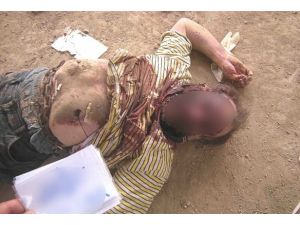 Suriye'de işkence fotoğraflarda görünenden daha fazla