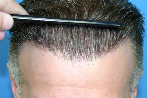 Saçlarınızla Işıldayın