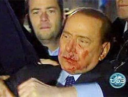 Berlusconi 24 Saat Gözetim Altında