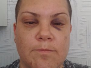 EVİNİN ÖNÜNDE DARP EDİLDİ