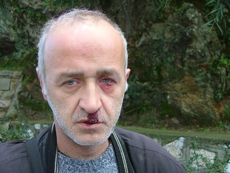 Kanal 48 muhabirine saldırı